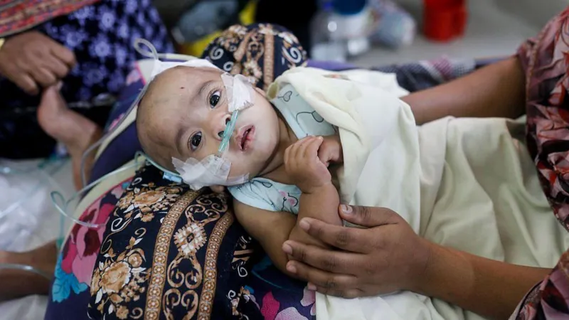 Bangladesh Launches Emergency Measles Vaccination Drive After Over 100 Child Deaths